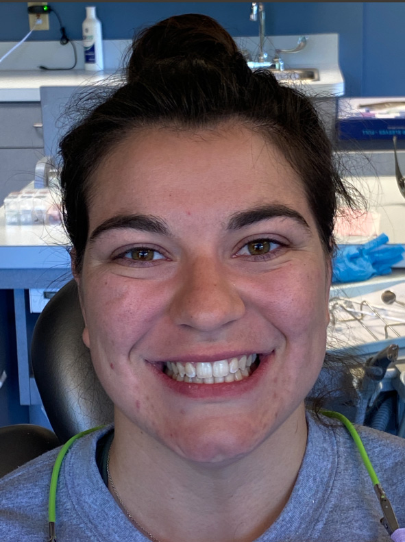 girl smiling after invisalign