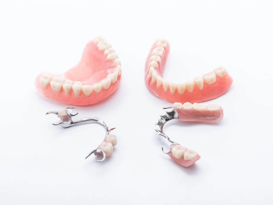 Dentures and denture services available at Dental Reflections Dublin in Dublin, OH